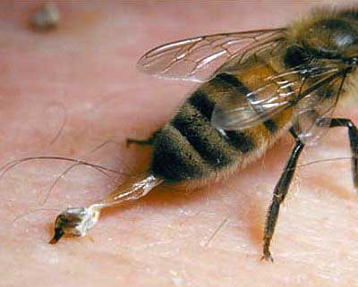 Remediu naturist Venin de albine pe terapiinaturiste.info